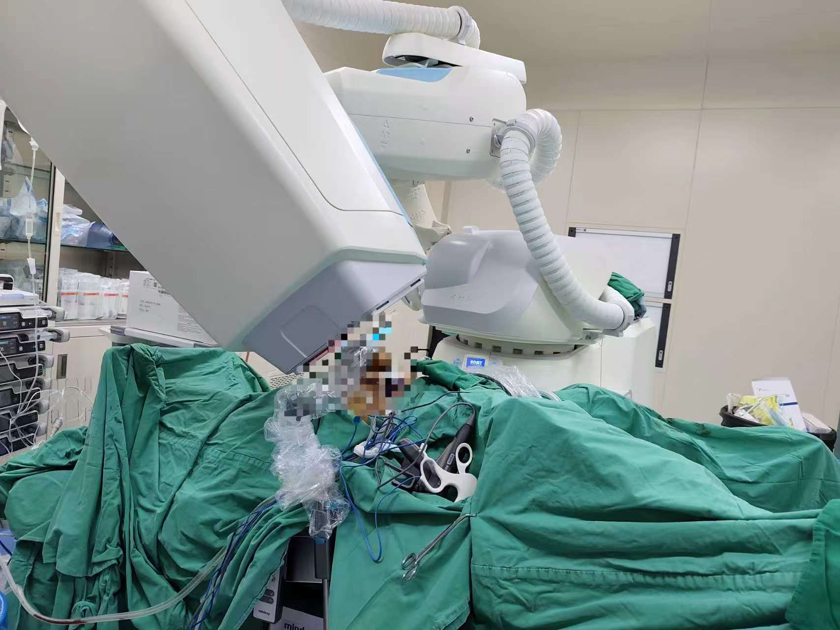 World’s First Laparoscopic IORT Procedure for Rectal Cancer Completed