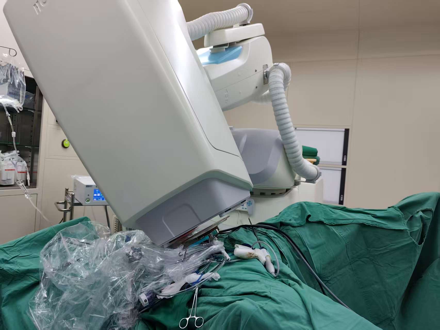 World’s First Rectal Cancer IORT with an Electron Beam Spherical Applicator Completed