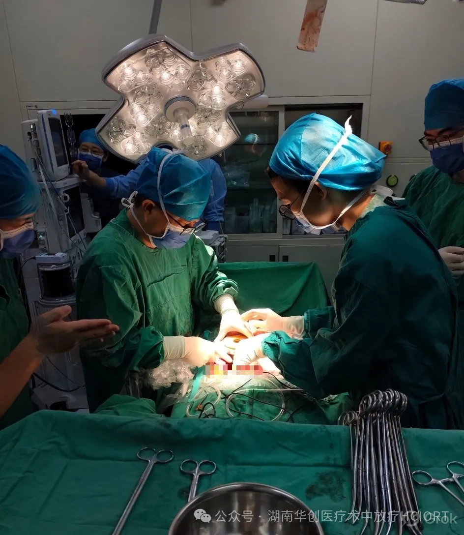 World’s First Retroperitoneal Liposarcoma IORT with an Electron Beam Spherical Applicator Completed