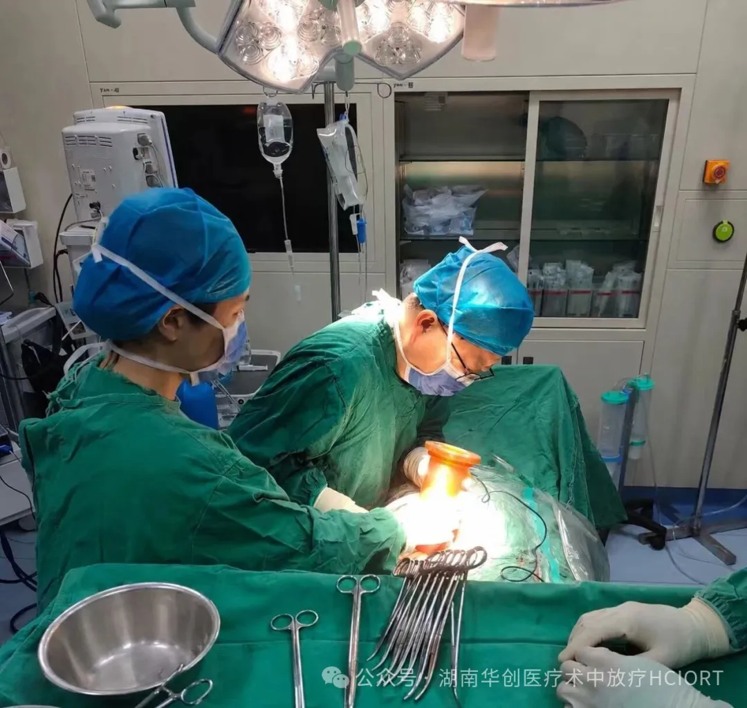 Hunan’s First Two-Field IORT Procedure for an Ascending Colon Tumor Completed