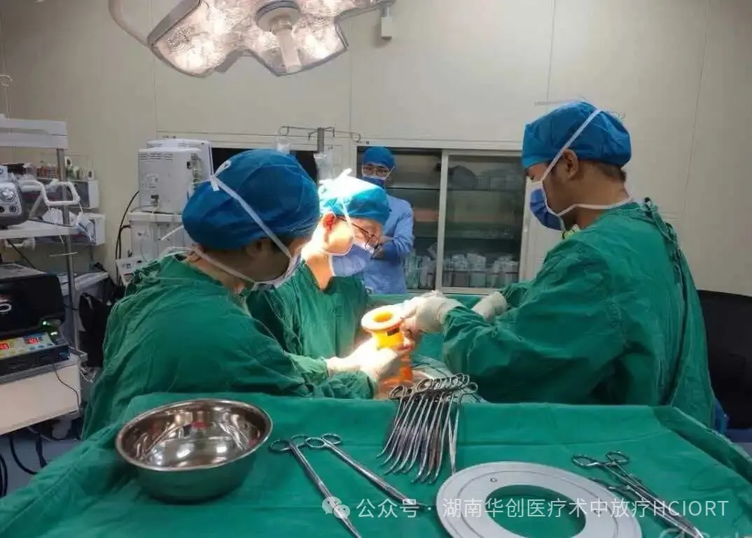 Hunan’s First Two-Field IORT Procedure for an Ascending Colon Tumor Completed
