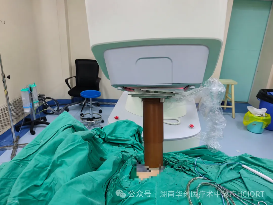 Hunan’s First Electron Beam IORT for Basal Cell Carcinoma of the Chest Skin Completed