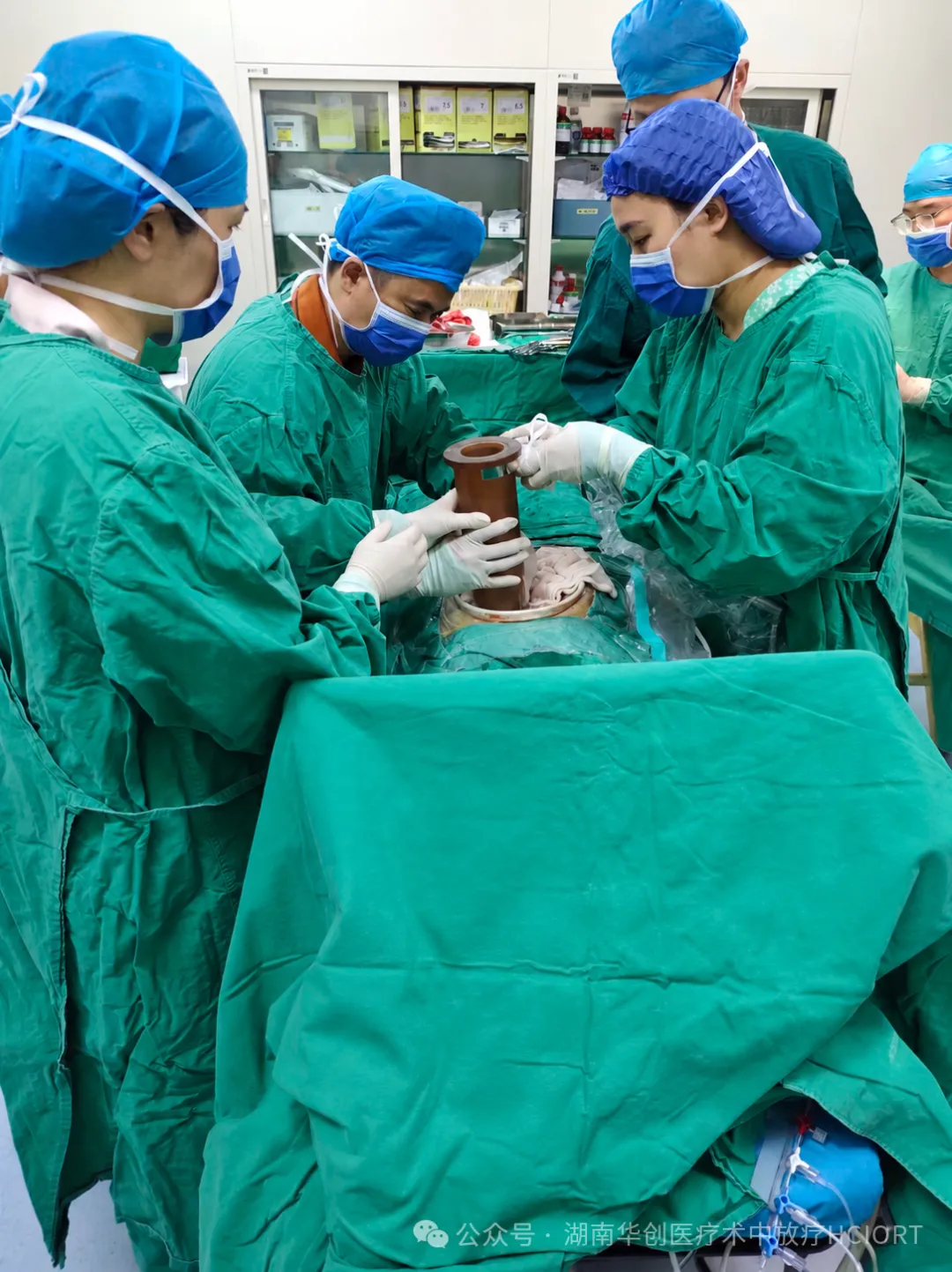 Hunan’s First Two-Lesion, Two-Field IORT Completed During a Single Retroperitoneal Tumor Operation