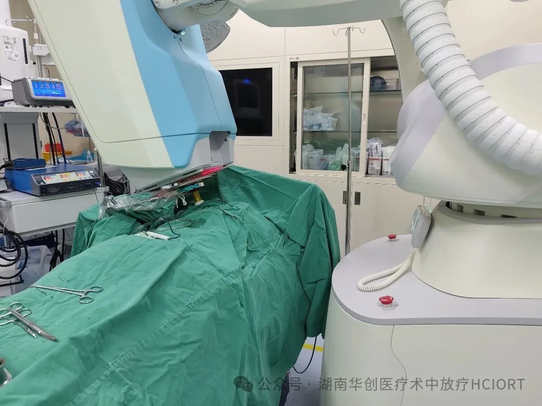 Two Breast Cancer IORT Cases Completed with a High-Dose-Rate Electron Beam Spherical Applicator